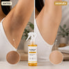 DR. MELAXIN PEEL SHOT™ – PIEL MÁS LIMPIA Y SUAVE